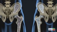 نکات مهم برای افزایش قدرت استخوانها