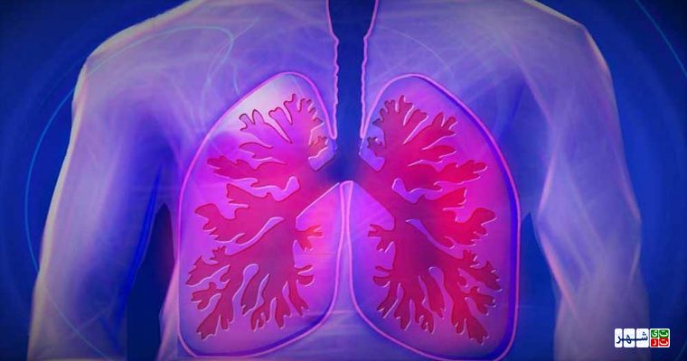 نشانه های اختلال در کارکرد ریه را بشناسید