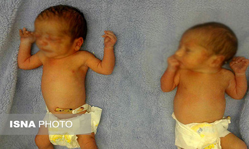 دو نوزاد رهاشده بندرعباسی در سلامتی کامل هستند