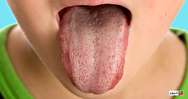 نشانه‌های بیماری خطرناک که در دهان ظاهر می شود