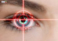 پاسخ به پرسش های شما درباره عمل لیزیک چشم