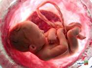 سقط مکرر ۲ تا ۵ درصد زنان در سنین باروری