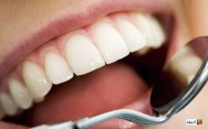 سلامت دهان و دندان در گرو تغذیه شما!