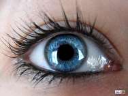 سندرم خشکی چشم+ علل، علائم و درمان
