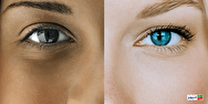 تغییر رنگ پوست نشانه چیست؟