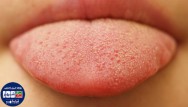 علت سفید شدن زبان؛ جلوگیری و درمان خانگی آن