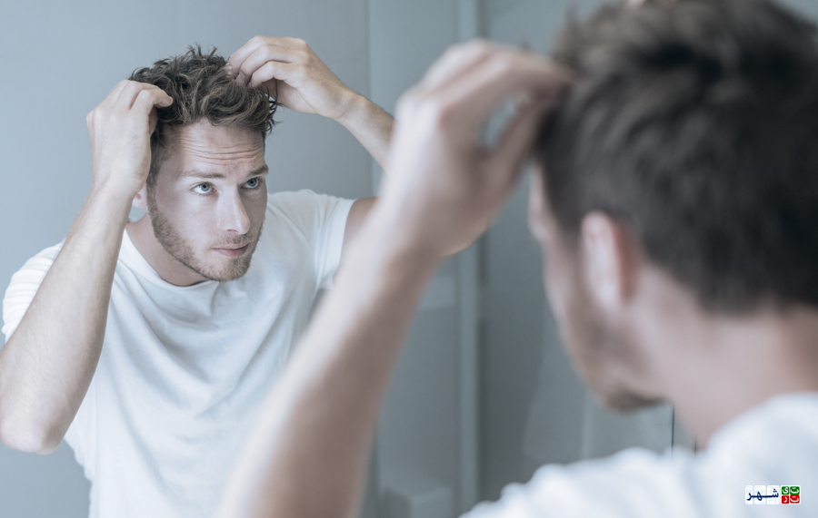 علت زود سفید شدن مو چیست؟