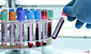 تشخیص8 نوع سرطان با آزمایش خون ساده‌